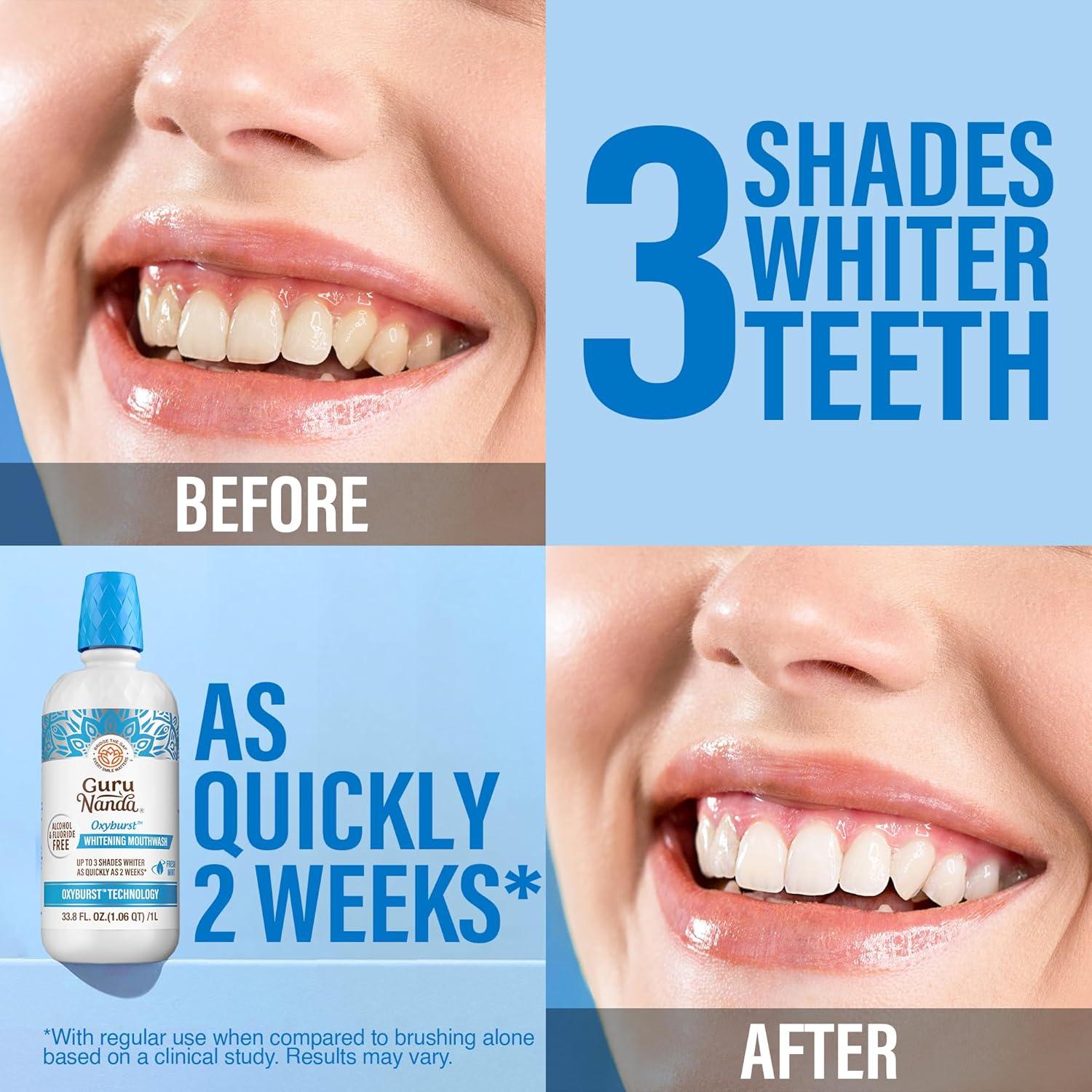 imageGuruNanda Oxyburst Teeth Whitening Mouthwash Alcohol ampamp Fluoride Free with Hydrogen Peroxide ampamp 7 Essential Oils for OnTheGo Freshness TSA Friendly Wild Mint 3 fl oz338 Fl Oz Pack of 1