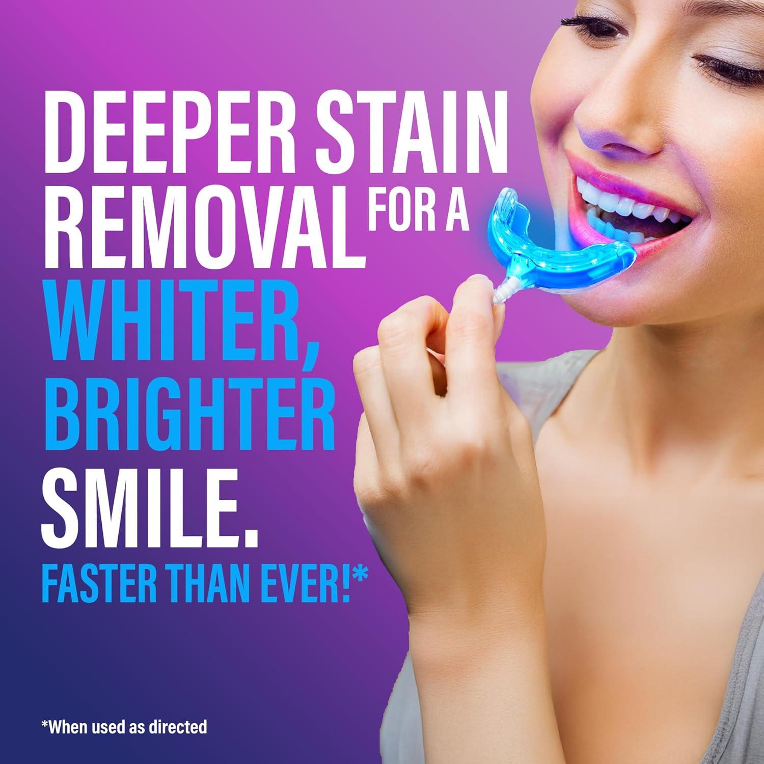 imageGuruNanda Premium Teeth Whitening Kit with Wired LED Light ampamp Whitening Pen Works with iPhone ampamp Android Helps Remove Surface Stains from Coffee Food Soda