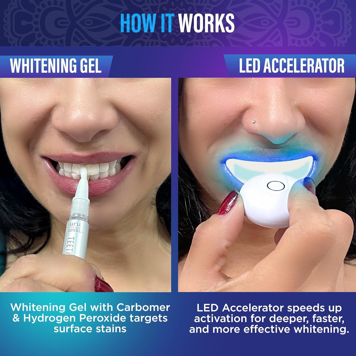 imageGuruNanda Professional Teeth Whitening Wireless Kit with LED Light ampamp Whitening Pen Helps Remove Surface Stains from Coffee Food Soda 40 Treatments