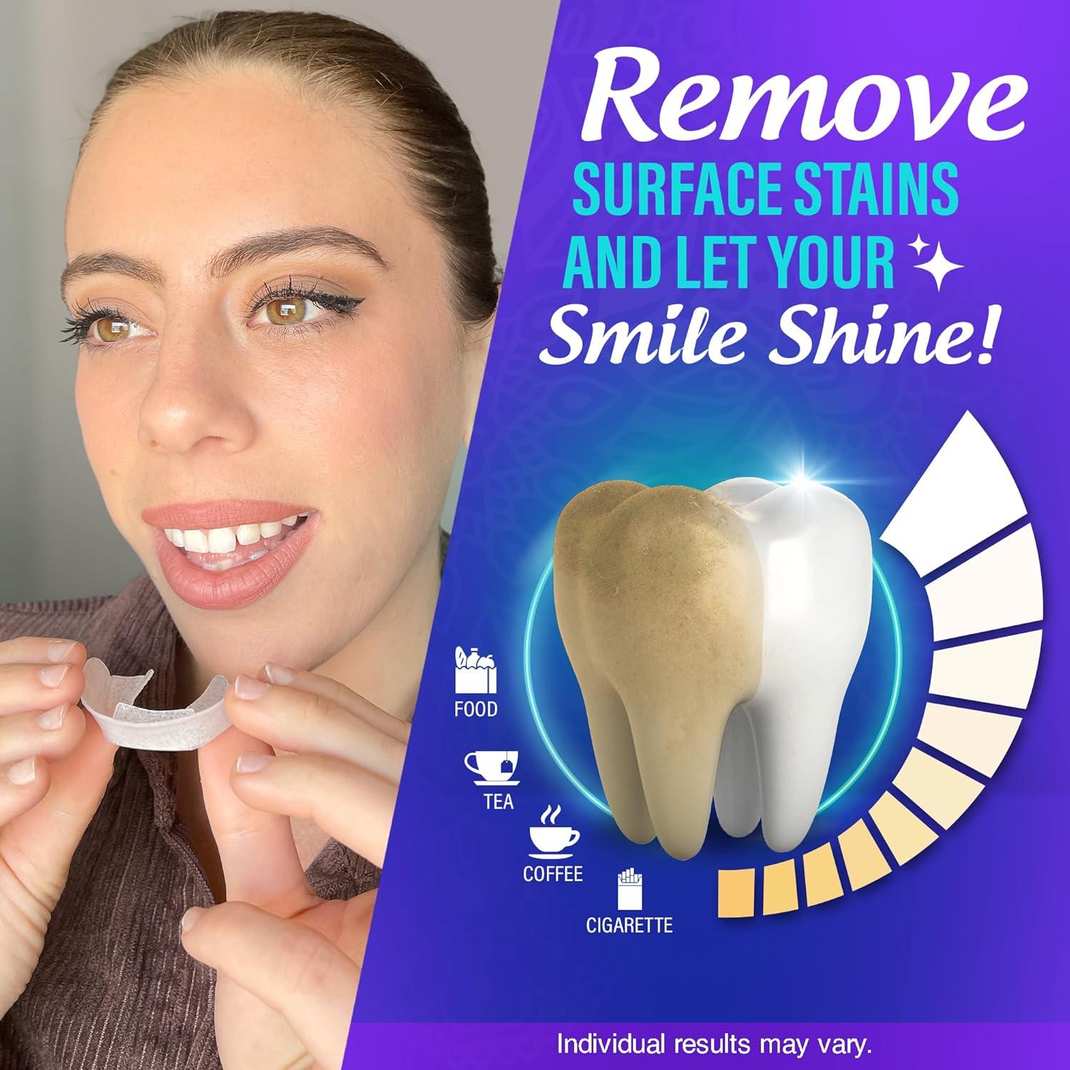 imageGuruNanda ReadytoUse Prefilled Whitening Trays 7 Treatments with 8 Hydrogen Peroxide to Remove Surface Stains Fast ampamp Easy Teeth Whitening for Sensitive Smiles