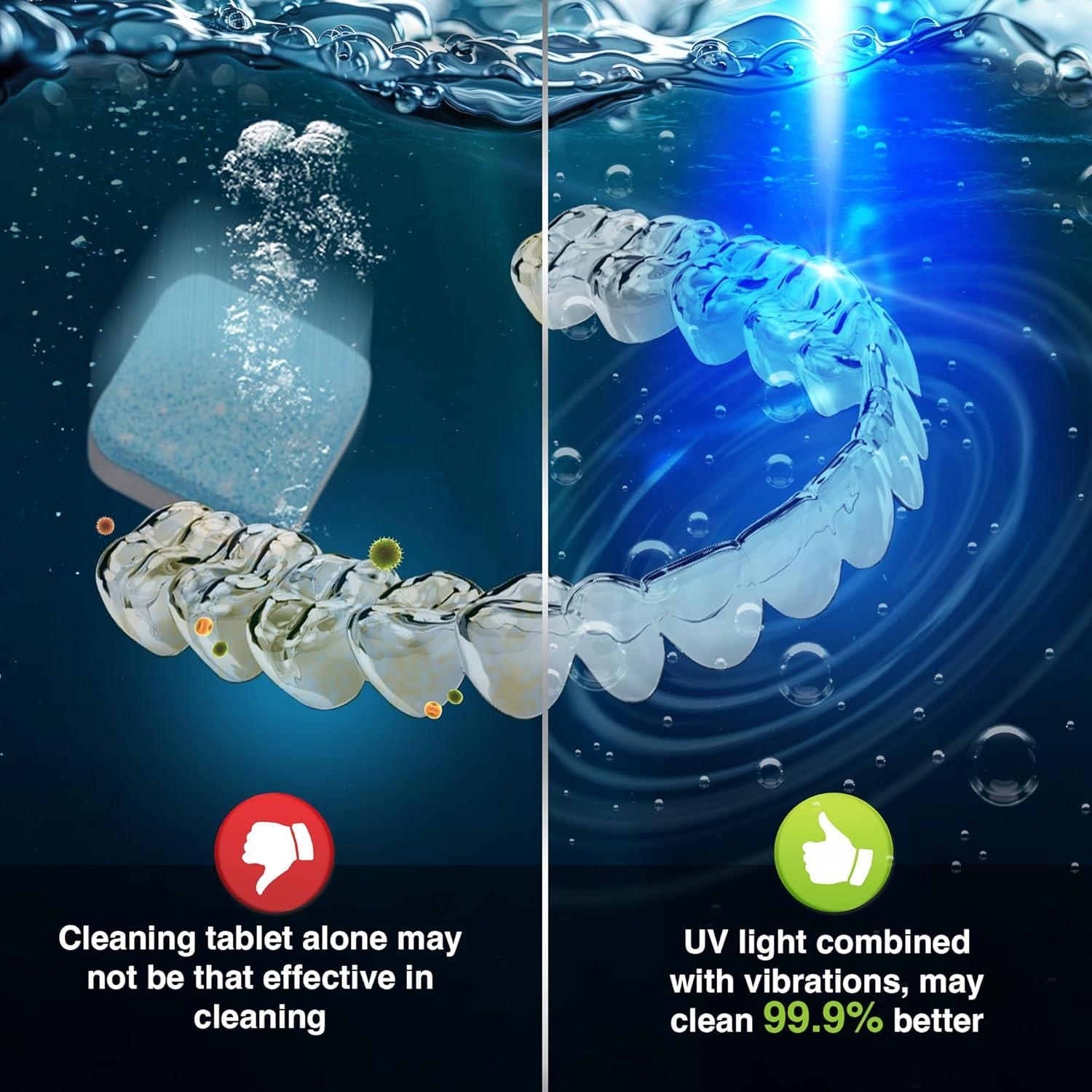 imageGuruNanda Retainer ampamp Aligner Cleaning Pod for Retainers Dentures Mouthguards Aligners ampamp Jewelry 3 Modes 45kHz Ultrasonic Retainer Cleaner 190 ml capacity